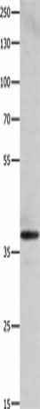 Anti-Human/Mouse/Rat HMOX2 Antibody