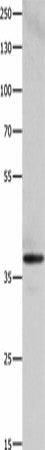 Western blot analysis of HepG2 cells using HMOX2 Polyclonal Antibody at dilution of 1:500
