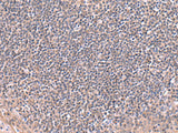 Immunohistochemistry of paraffin-embedded Human tonsil tissue using RIC8A Polyclonal Antibody at dilution of 1:80(×200)