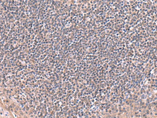 Immunohistochemistry of paraffin-embedded Human tonsil tissue using RIC8A Polyclonal Antibody at dilution of 1:80(×200)