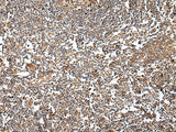 Anti-Human/Mouse VSIG8 Antibody - ABMIUM