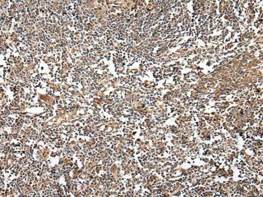 Anti-Human/Mouse VSIG8 Antibody