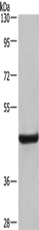 Anti-Human LAMP2 Antibody - ABMIUM