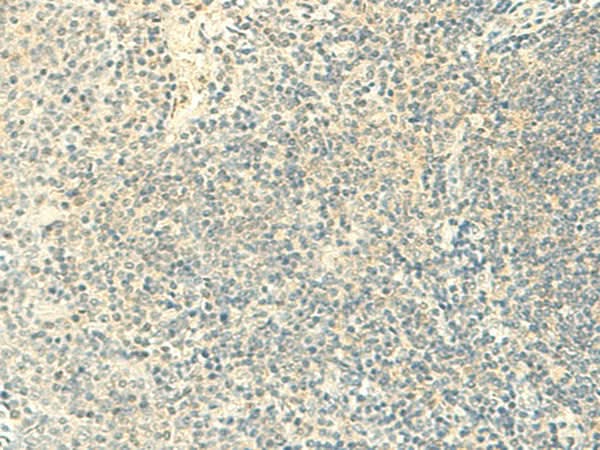 Immunohistochemistry of paraffin-embedded Human tonsil tissue using FMNL2 Polyclonal Antibody at dilution of 1:50(×200)