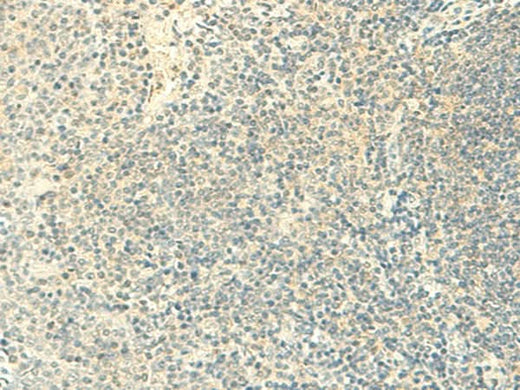 Immunohistochemistry of paraffin-embedded Human tonsil tissue using FMNL2 Polyclonal Antibody at dilution of 1:50(×200)