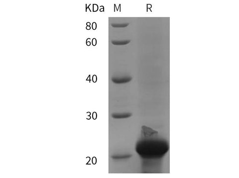 SDS-PAGE analysis of Mouse CASP1 proteins, 2 μg/lane of Recombinant Mouse CASP1 proteins was resolved with SDS-PAGE under reducing conditions, showing bands at 21 kDa.