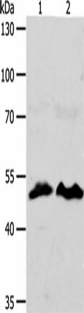 Western blot analysis of HT29 cells hela cells using ZWILCH Polyclonal Antibody at dilution of 1:1750