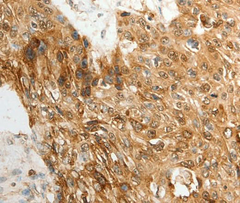 Anti-Human/Mouse TENM3 Antibody - ABMIUM