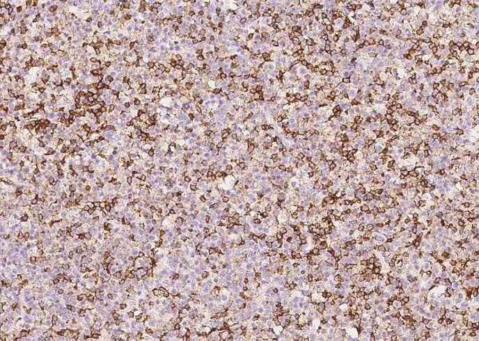 Anti-Human PTPRC Antibody [A1020] - ABMIUM