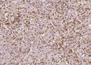 Anti-Human PTPRC Antibody [A1020] - ABMIUM