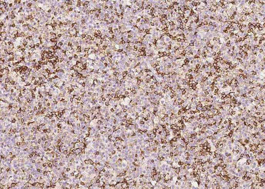 Anti-Human PTPRC Antibody [A1020] - ABMIUM