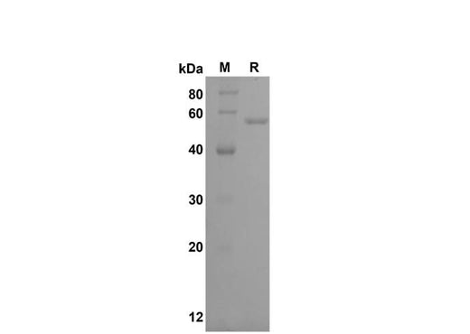 Recombinant Rat LCN2 Protein(Halo Tag) - ABMIUM