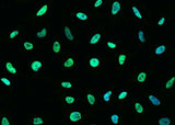 Anti-Human/Cynomolgus/Mouse/Rat/Ferret MSH6 Antibody [A1290] - ABMIUM