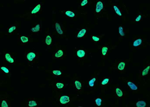 Anti-Human/Cynomolgus/Mouse/Rat/Ferret MSH6 Antibody [A1290] - ABMIUM