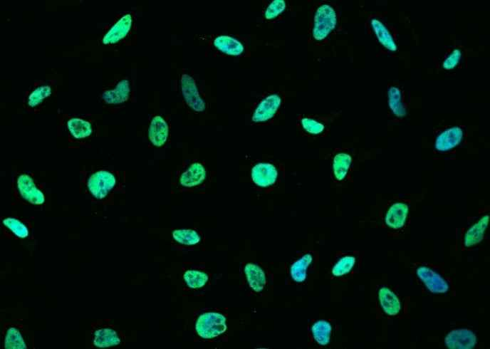 Anti-Human/Cynomolgus/Mouse/Rat/Ferret MSH6 Antibody [A1290] - ABMIUM
