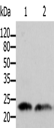 Anti-Human/Mouse/Rat ARF1 Antibody - ABMIUM