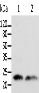 Anti-Human/Mouse/Rat ARF1 Antibody - ABMIUM
