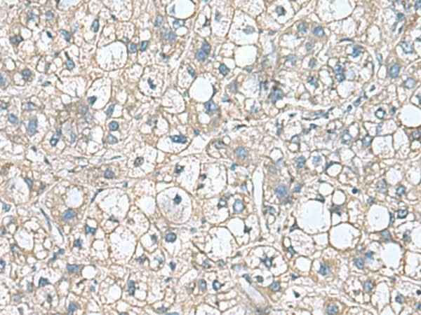 Anti-Human RHBDL2 Antibody