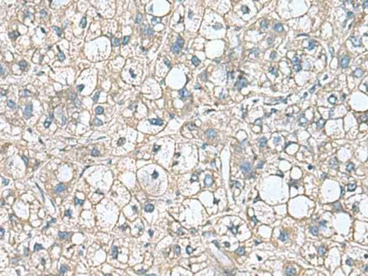 Anti-Human RHBDL2 Antibody