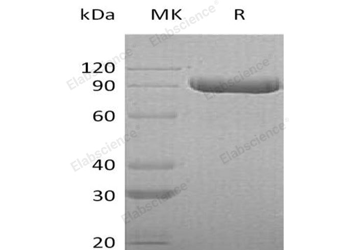 Recombinant Human ITIH3 Protein (His Tag) - ABMIUM
