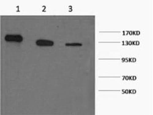 Western Blot analysis of 1) Hela, 2) 293T, 3) Jurkat cells using PARP1 Monoclonal Antibody at dilution of 1:2000.