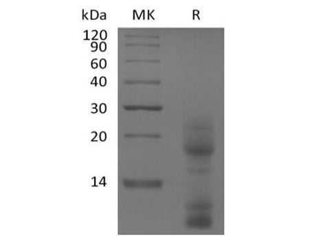 Recombinant Human TSLP (C-10His) - ABMIUM