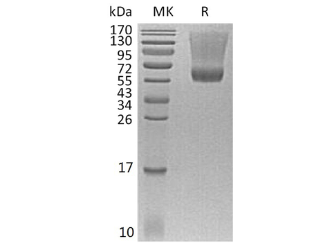 Recombinant Human Renin Protein (His Tag) - ABMIUM