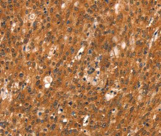 Anti-Human/Mouse/Rat DAB2IP Antibody