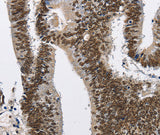 Anti-Human CMTM2 Antibody - ABMIUM