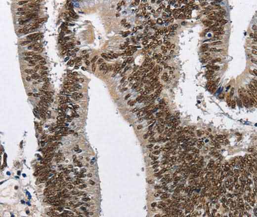 Anti-Human CMTM2 Antibody