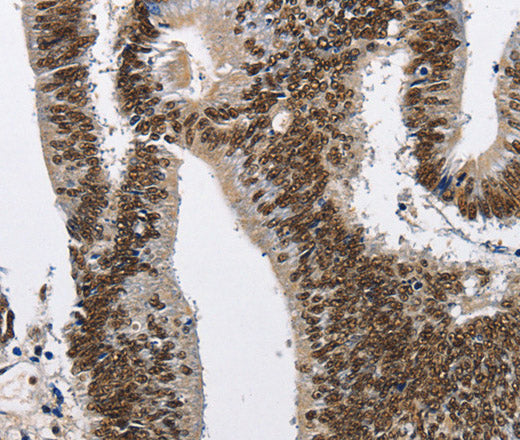 Anti-Human CMTM2 Antibody - ABMIUM
