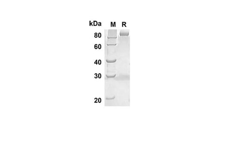 SDS-PAGE analysis of Mouse ANGPTL3 proteins, 2 μg/lane of Recombinant Human Mouse ANGPTL3 was resolved with SDS-PAGE under reducing conditions, showing bands at 73.2 kDa.