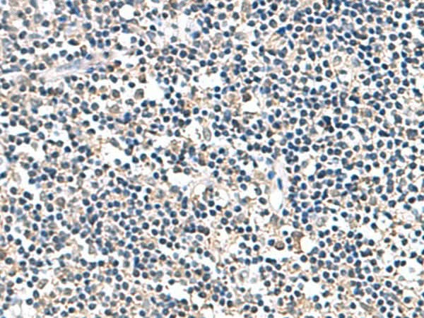 Immunohistochemistry of paraffin-embedded Human tonsil tissue using ATP5F1D Polyclonal Antibody at dilution of 1:80(×200)