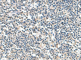 Immunohistochemistry of paraffin-embedded Human tonsil tissue using ATP5F1D Polyclonal Antibody at dilution of 1:80(×200)
