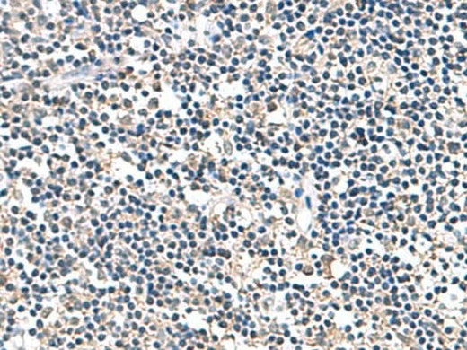 Immunohistochemistry of paraffin-embedded Human tonsil tissue using ATP5F1D Polyclonal Antibody at dilution of 1:80(×200)
