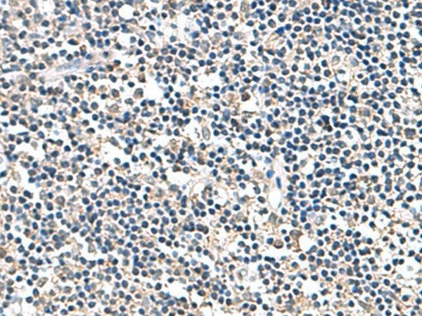 Immunohistochemistry of paraffin-embedded Human tonsil tissue using ATP5F1D Polyclonal Antibody at dilution of 1:80(×200)