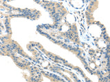 Anti-Human/Mouse/Rat VPS36 Antibody - ABMIUM