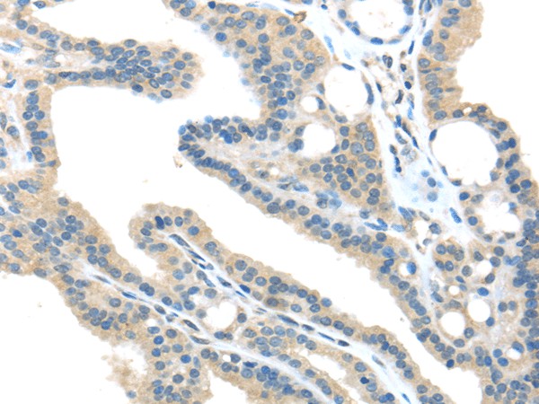 Anti-Human/Mouse/Rat VPS36 Antibody - ABMIUM