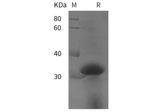 SDS-PAGE analysis of Human Collagen alpha-1(I)chain/COL1A1 proteins, 2 μg/lane of Recombinant Human Collagen alpha-1(I)chain/COL1A1 proteins was resolved with SDS-PAGE under reducing conditions, showing bands at 32 kDa.