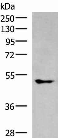 Anti-Human/Mouse/Rat KCNJ2 Antibody