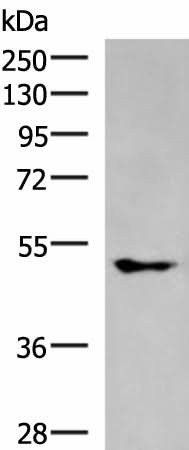 Western blot analysis of A549 cell lysate using KCNJ2 Polyclonal Antibody at dilution of 1:550
