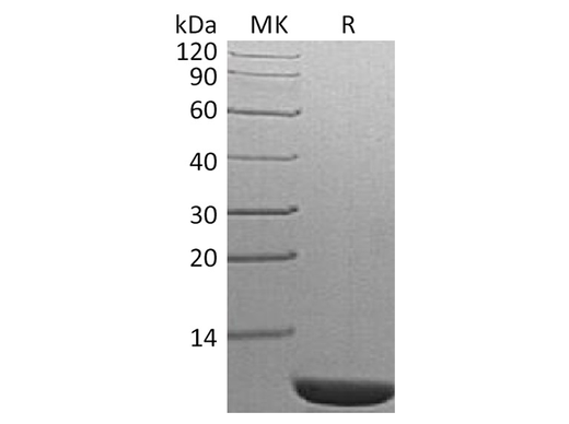 Recombinant S. cerevisiae TIM14 Protein - ABMIUM