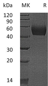 Recombinant Mouse Lumican/LUM Protein (His Tag) - ABMIUM