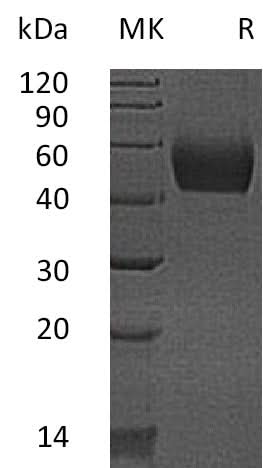 Recombinant Mouse Lumican/LUM Protein (His Tag) - ABMIUM