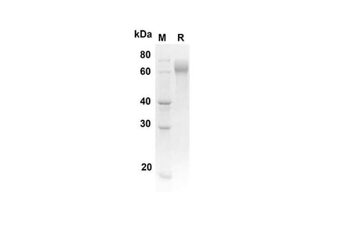 SDS-PAGE analysis of Rat FGFR4 proteins, 2 μg/lane of Recombinant Rat FGFR4 proteins was resolved with an SDS-PAGE under reducing conditions, showing bands at 38.5 kDa.
