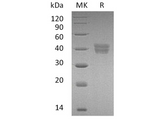 > 95 % as determined by reducing SDS-PAGE.