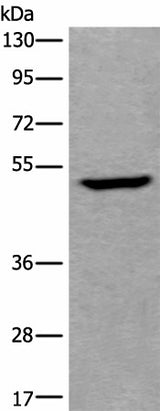 Western blot analysis of Human fetal liver tissue lysate using UMPS Polyclonal Antibody at dilution of 1:400
