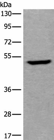 Western blot analysis of Human fetal liver tissue lysate using UMPS Polyclonal Antibody at dilution of 1:400