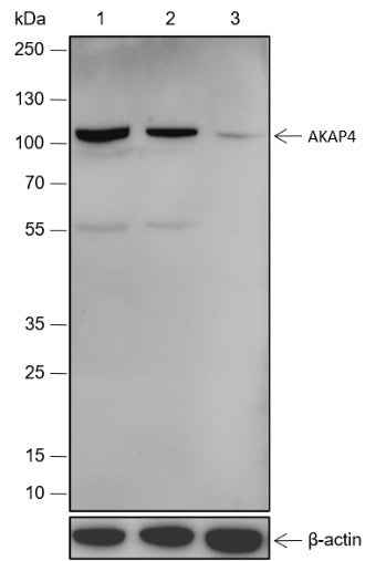 Anti-Human/Rat/Mouse AKAP4 Antibody [A494]
