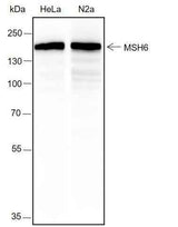 Anti-Human/Rat/Mouse MSH6 Antibody [A308]
